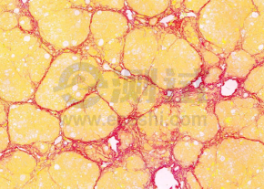 f3f803e34b2ec45c339984c8a35b7daa f3f803e34b2ec45c339984c8a35b7daa