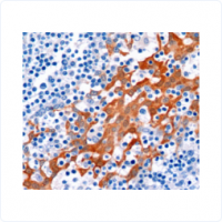 免疫組化、免疫熒光