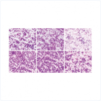 細(xì)胞遷移/侵襲實(shí)驗(yàn)